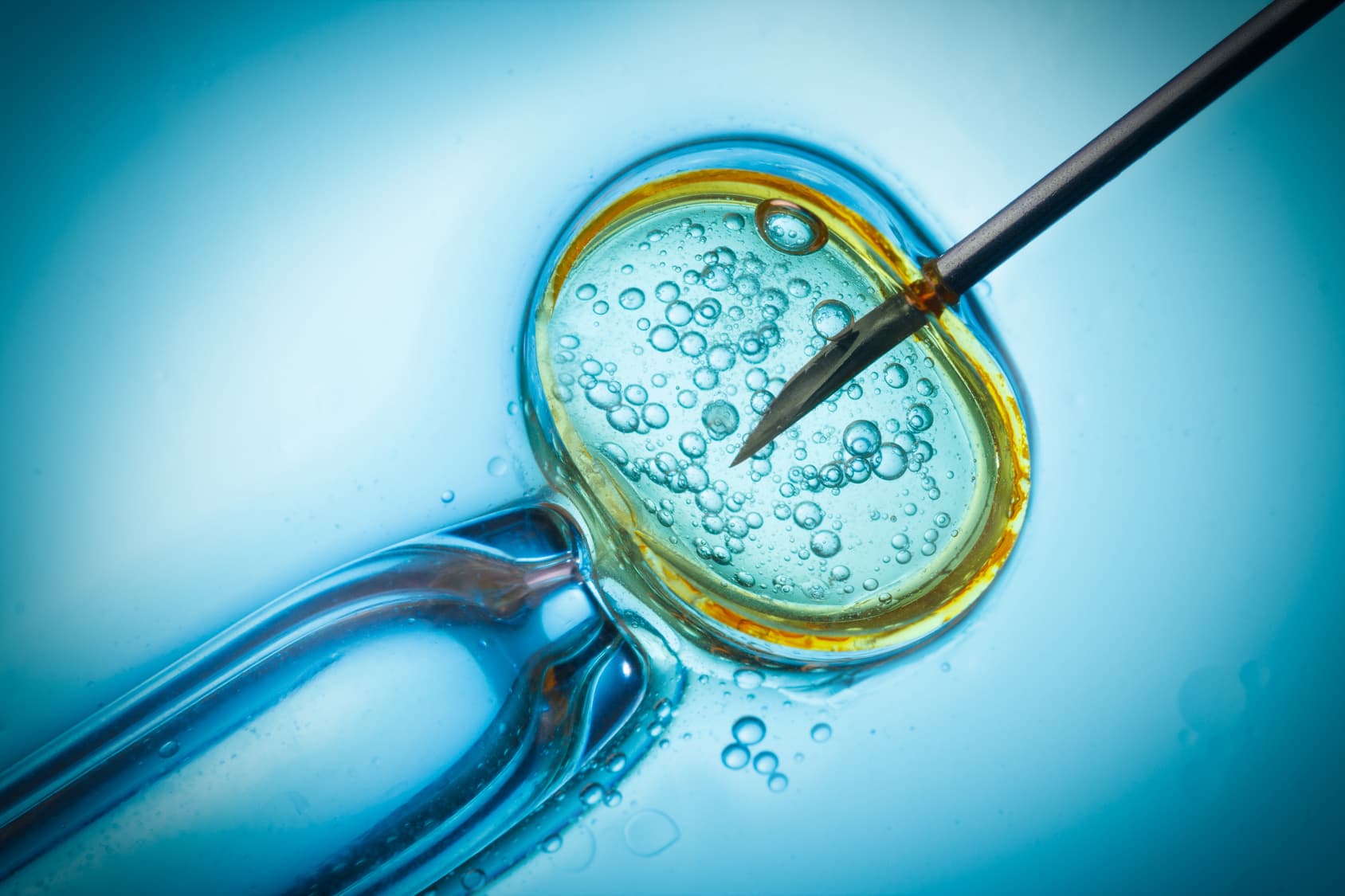 Frische oder gefrorene Spender­eizellen bei IVF: Welche Option ist besser?